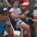 Notícias NRL 2026 | Problema no pulso de Jahrome Hughes; Lesão na panturrilha de Brandon Smith; Resultado, vídeo e destaques do South Sydney Rabbitohs x Melbourne Storm